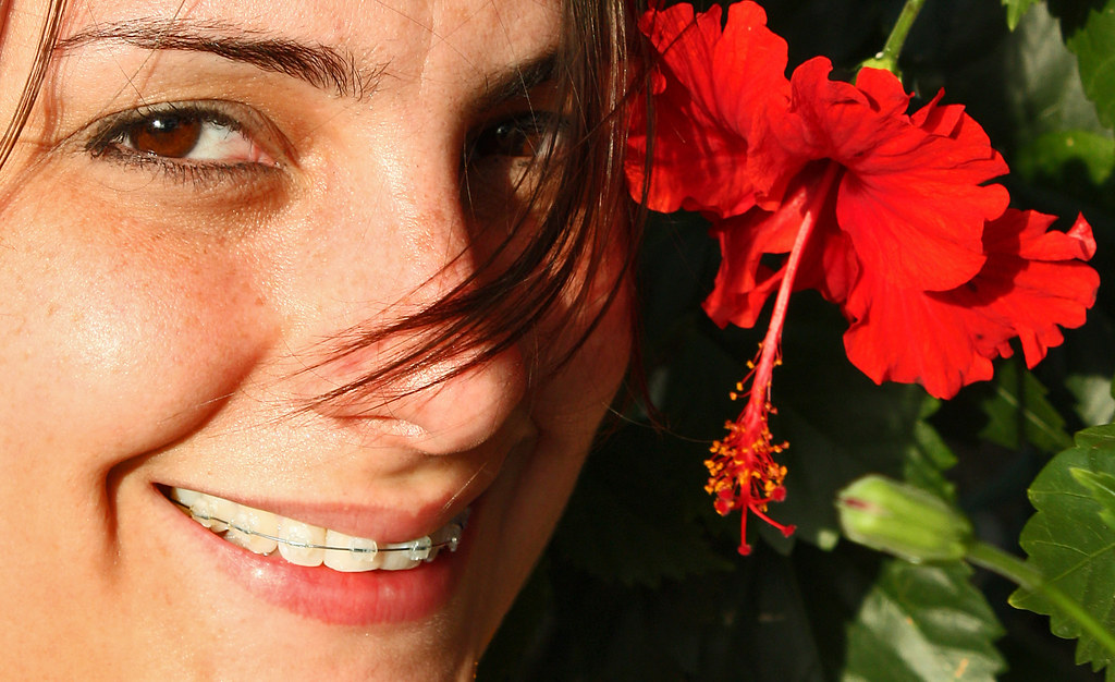 Ortodoncia Invisalign